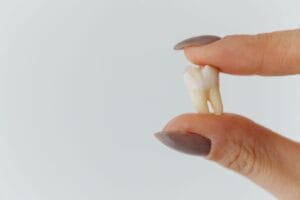 Why do I keep dreaming my teeth are falling out?